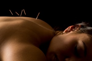 how-does-acupuncture-feel