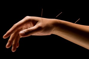 acupuncture therapy in leigh on sea
